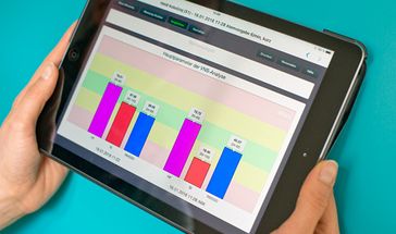 VNS-Analyse (HVR, HFV), Auswertung beim Zahnarzt Fürth/Nürnberg.